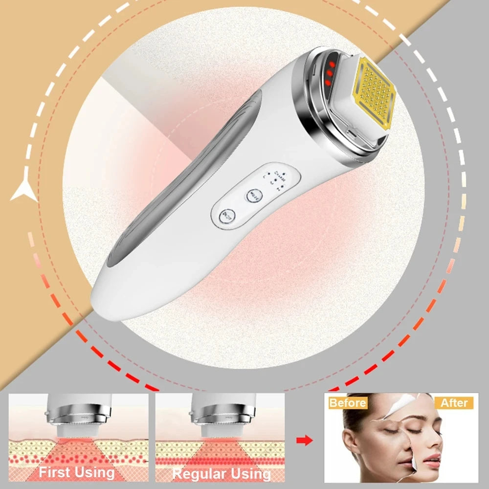 Duvette RadianceLift Pro - Electric Facial Lifting & Rejuvenation Device