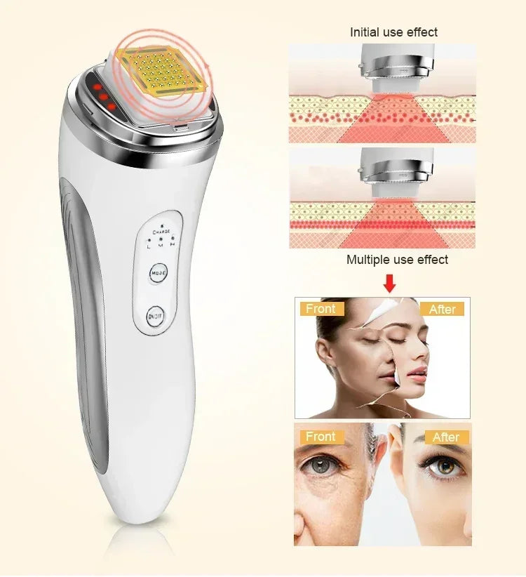 Duvette RadianceLift Pro - Electric Facial Lifting & Rejuvenation Device