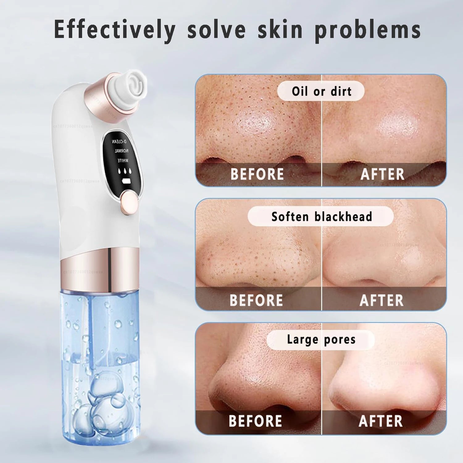 Duvette PureVac - Water Cycle Blackhead Remover & Deep Cleanser