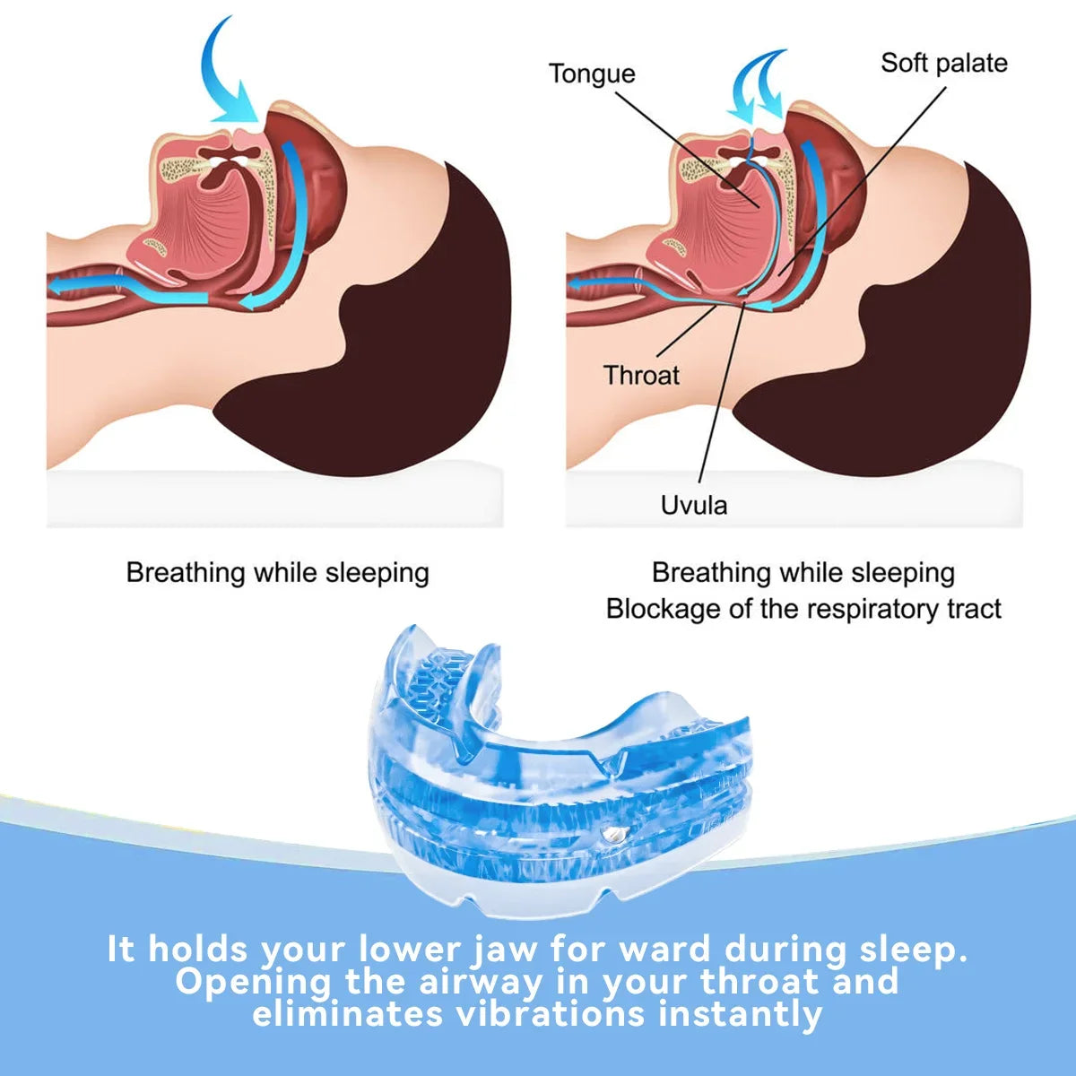 Duvette Adjustable Anti-Snoring Mouth Guard