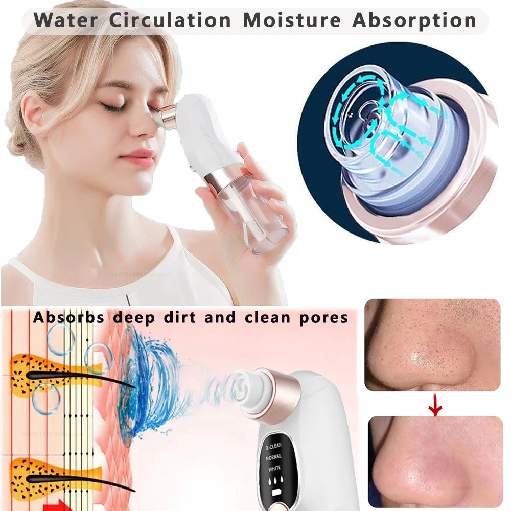 Duvette PureVac - Water Cycle Blackhead Remover & Deep Cleanser